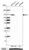 Anti-ACLY antibody produced in rabbit Prestige Antibodies&#174; Powered by Atlas Antibodies, affinity isolated antibody, buffered aqueous glycerol solution