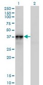 Monoclonal Anti-NOV antibody produced in mouse clone 3C2, purified immunoglobulin, buffered aqueous solution