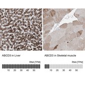 Anti-ABCD3 antibody produced in rabbit Prestige Antibodies&#174; Powered by Atlas Antibodies, affinity isolated antibody, buffered aqueous glycerol solution