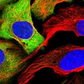 Anti-PKM antibody produced in rabbit Prestige Antibodies&#174; Powered by Atlas Antibodies, affinity isolated antibody, buffered aqueous glycerol solution