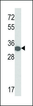 ANTI-HIS TAG antibody produced in rabbit purified immunoglobulin, buffered aqueous solution