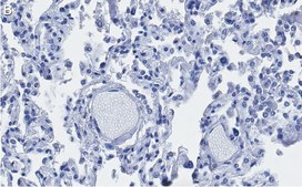 Anti-ACE2-extracellular Antibody, clone 1F21 ZooMAb&#174; Rabbit Monoclonal recombinant, expressed in HEK 293 cells