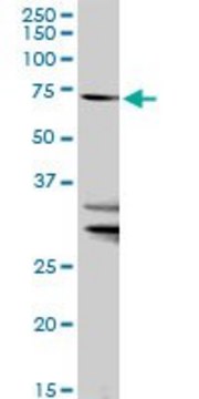 Anti-SLC27A1 antibody produced in rabbit purified immunoglobulin, buffered aqueous solution