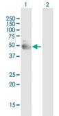 Anti-NR1I2 antibody produced in mouse purified immunoglobulin, buffered aqueous solution