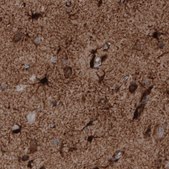 Monoclonal Anti-GLUL antibody produced in mouse Prestige Antibodies&#174; Powered by Atlas Antibodies, clone CL3013, purified immunoglobulin, buffered aqueous glycerol solution