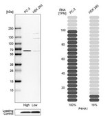 Anti-P4HA1 antibody produced in rabbit Prestige Antibodies&#174; Powered by Atlas Antibodies, affinity isolated antibody, buffered aqueous glycerol solution