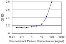 Monoclonal Anti-ACP5 antibody produced in mouse clone 2D9, purified immunoglobulin, buffered aqueous solution