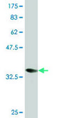 Monoclonal Anti-CORO1A, (C-terminal) antibody produced in mouse clone 1A8, purified immunoglobulin, buffered aqueous solution