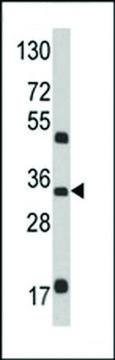 ANTI-M6PR(N-TERMINAL) antibody produced in rabbit purified immunoglobulin, buffered aqueous solution