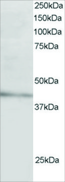 Anti-ARH/LDL Receptor Adaptor antibody produced in goat affinity isolated antibody, buffered aqueous solution