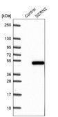 Anti-SCRN2 antibody produced in rabbit Prestige Antibodies&#174; Powered by Atlas Antibodies, affinity isolated antibody, buffered aqueous glycerol solution, Ab1
