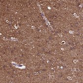 Anti-TUBA1A antibody produced in rabbit Prestige Antibodies&#174; Powered by Atlas Antibodies, affinity isolated antibody, buffered aqueous glycerol solution