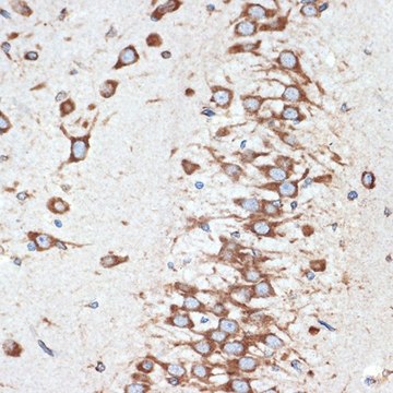 Anti-LMAN1 antibody produced in rabbit