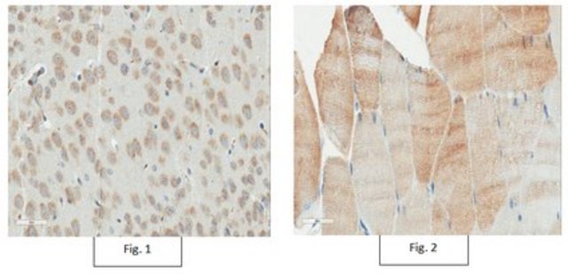 Anti-TRIM3 Antibody, clone 13D12.1 clone 13D12.1, from mouse