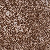 Anti-THRAP3 antibody produced in rabbit Prestige Antibodies&#174; Powered by Atlas Antibodies, affinity isolated antibody, buffered aqueous glycerol solution