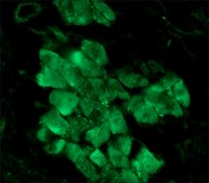 Anti-Myosin (Skeletal) antibody produced in rabbit whole antiserum