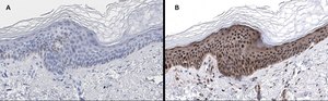 Anti-phos-AMPK&#945; (Thr172) Antibody, clone 5J23 , ZooMAb&#174; Rabbit Monoclonal recombinant, expressed in HEK 293 cells
