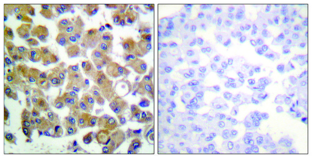 Anti-TGF &#946;1 antibody produced in rabbit affinity isolated antibody