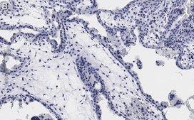 Anti-Integrin &#945;-5 Antibody, clone 5E18 ZooMAb&#174; Rabbit Monoclonal recombinant, expressed in HEK 293 cells