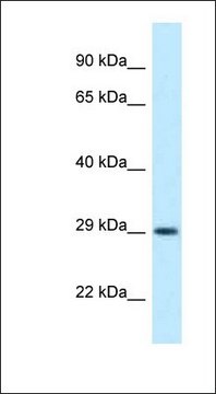 Anti-OLIG1 antibody produced in rabbit affinity isolated antibody