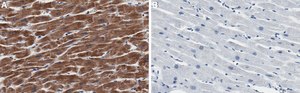 Anti-AGK Antibody, clone 1F21 ZooMAb&#174; Rabbit Monoclonal recombinant, expressed in HEK 293 cells
