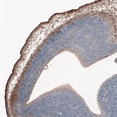 Monoclonal Anti-RELN antibody produced in mouse Prestige Antibodies&#174; Powered by Atlas Antibodies, clone CL5324, purified immunoglobulin, buffered aqueous glycerol solution