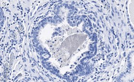 Anti-phospho-eIF-2&#945;-Ser51 Antibody, clone 4N22 ZooMAb&#174; Rabbit Monoclonal recombinant, expressed in HEK 293 cells