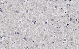 Anti-Tau Antibody, clone Tau 12 ZooMAb&#174; Mouse Monoclonal recombinant, expressed in HEK 293 cells