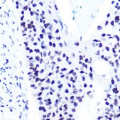 Anti-Phospho-STAT1-S727 antibody produced in rabbit