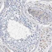 Anti-MAP2K6 antibody produced in rabbit Prestige Antibodies&#174; Powered by Atlas Antibodies, affinity isolated antibody, buffered aqueous glycerol solution