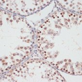Anti-Phospho-AKT1S1-T246 antibody produced in rabbit
