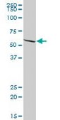 Anti-EPHX2 antibody produced in mouse IgG fraction of antiserum, buffered aqueous solution