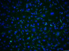 OSUMMER.10 Mouse NRAS-Mutant Melanoma Cell Line