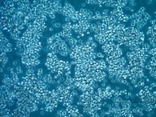 CH27 Mouse B Cell Lymphoma Cell Line CH27 mouse B cell lymphoma celll line is a useful model for the study of B-cell biology and tumor immunology.