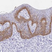 Anti-KRT13 antibody produced in rabbit Prestige Antibodies&#174; Powered by Atlas Antibodies, affinity isolated antibody, buffered aqueous glycerol solution