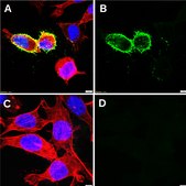 Anti-RABV Glycoprotein Antibody, clone D1-25 ZooMAb&#174; Mouse Monoclonal recombinant, expressed in HEK 293 cells
