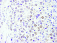 Rabbit anti-BRG1/SMARCA4 Antibody, Affinity Purified Powered by Bethyl Laboratories, Inc.