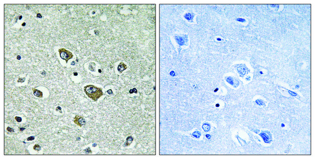 Anti-ZDHHC9 antibody produced in rabbit affinity isolated antibody