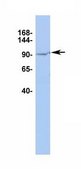 Anti-TRPV4 antibody produced in rabbit affinity isolated antibody