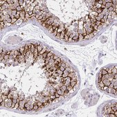 Anti-KIAA1210 antibody produced in rabbit Prestige Antibodies&#174; Powered by Atlas Antibodies, affinity isolated antibody, buffered aqueous glycerol solution