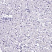 Anti-PGM2L1 antibody produced in rabbit Prestige Antibodies&#174; Powered by Atlas Antibodies, affinity isolated antibody, buffered aqueous glycerol solution