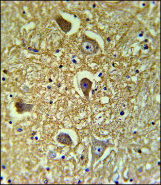 ANTI-HAS2 (CENTER) antibody produced in rabbit IgG fraction of antiserum, buffered aqueous solution