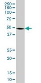 Anti-PLIN3 antibody produced in mouse purified immunoglobulin, buffered aqueous solution