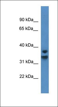 Anti-NFKBID antibody produced in rabbit affinity isolated antibody