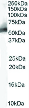 Anti-MDM2 (Isoform) antibody produced in goat affinity isolated antibody, buffered aqueous solution