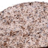Monoclonal Anti-Adam10 Antibody Produced In Mouse Prestige Antibodies&#174; Powered by Atlas Antibodies, clone CL13808, affinity isolated antibody, buffered aqueous glycerol solution