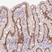 Anti-HNF1A antibody produced in rabbit Prestige Antibodies&#174; Powered by Atlas Antibodies, affinity isolated antibody, buffered aqueous glycerol solution