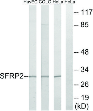 Anti-SFRP2 antibody produced in rabbit affinity isolated antibody