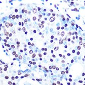 Anti-SFPQ antibody produced in rabbit