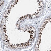 Anti-CCDC88A antibody produced in rabbit Prestige Antibodies&#174; Powered by Atlas Antibodies, affinity isolated antibody, buffered aqueous glycerol solution
